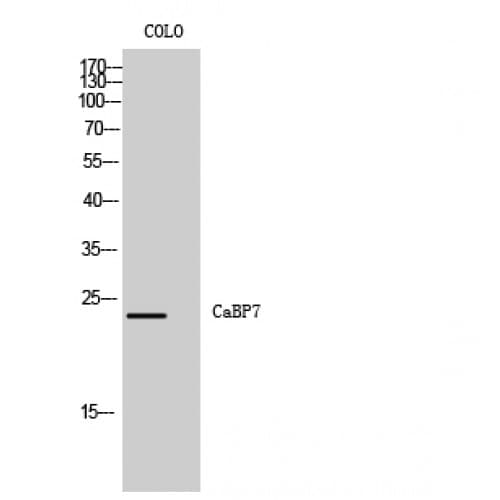 CABP7 Antibody (10-90 aa, N-terminal)
