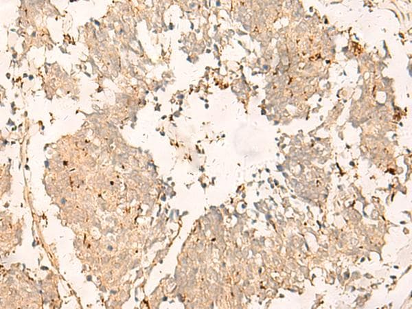 Polyclonal Rabbit anti-Human TEX11 Antibody (IHC)