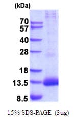 Human PI3 / Elafin Protein (Recombinant His)