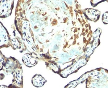 TIMP3 Antibody (aa175-211, Ready-to-Use)