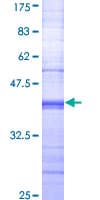 Human CD32A Protein (Recombinant GST, N-terminus)