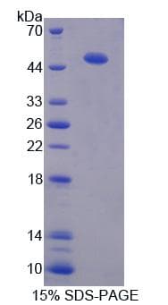 Human PDIA6 / ERP5 Protein (Recombinant His-T7)