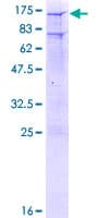 Human NR3C1/Glucocorticoid Receptor Protein (Recombinant GST)