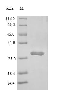 Mouse SIGIRR Protein (Recombinant 6His-SUMO, N-terminus)