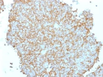 Polyclonal Rabbit anti-Human CD99 Antibody (IHC, IF)
