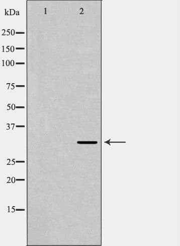 Polyclonal Rabbit anti-Human TPM3 Antibody (IHC, IF, WB)