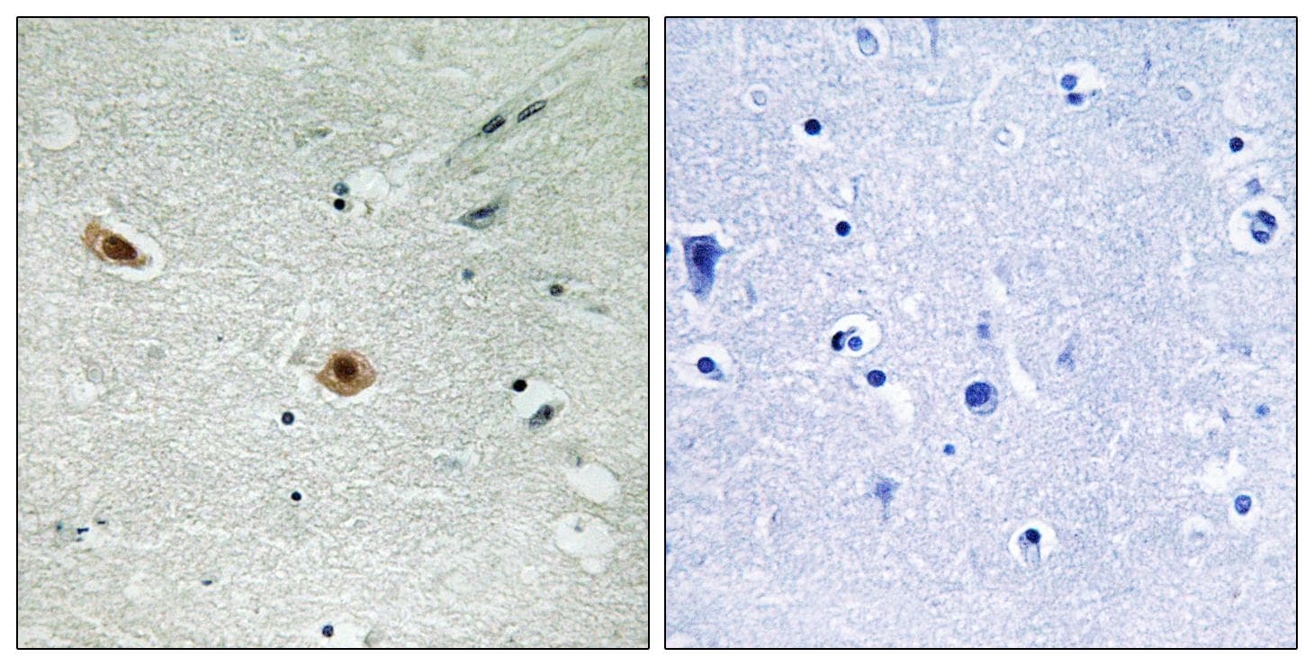 RB1 / Retinoblastoma / RB Antibody (phospho-Ser608)
