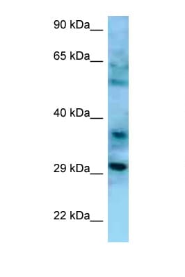 Polyclonal Rabbit anti-Human CD47 Antibody (aa60-109, WB)