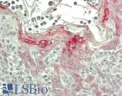 IHC-plus™ KRT13 / CK13 / Cytokeratin 13 Antibody (clone Ks13.1)