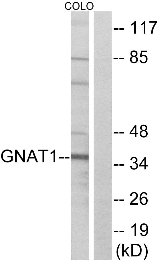 GNAT1 Antibody (aa71-120)