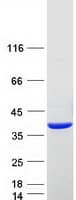 Human SULT2A1 / Sulfotransferase 2A1 Protein (Recombinant Myc-DDK (Flag))