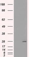 PRL / Prolactin Antibody (clone OTI11B11)