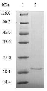 Human MOAP1 / MAP1 Protein (Recombinant GST, N-terminus)