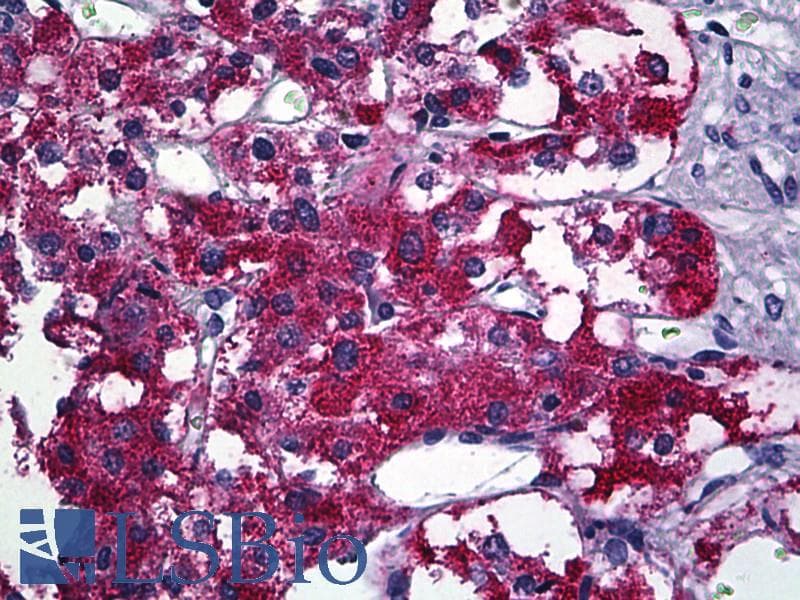 IHC-plus™ PIM1 / Pim-1 Antibody (clone 3F5)