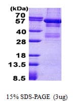 Human LYN Protein (Recombinant His)