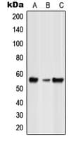 Polyclonal Rabbit anti-Human Spastic / GLRB Antibody (Internal, WB)