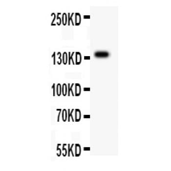 Polyclonal Rabbit anti-Human ATXN2 / SCA2 / Ataxin-2 Antibody (aa1283-1313, IHC, WB)