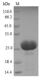 Human CD66d / CEACAM3 Protein (Recombinant 6His-SUMO, N-terminus)