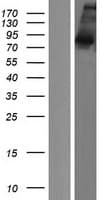 Human LAS1L Protein (Over-Expression Lysate Myc-DDK (Flag))