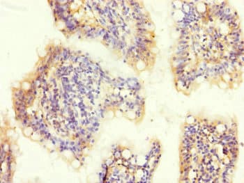 Polyclonal Rabbit anti-Human MTERF2 / MTERFD3 Antibody (IHC, WB)