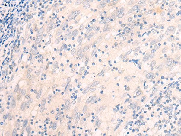 Polyclonal Rabbit anti-Human EME2 Antibody (IHC)