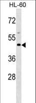 Basigin / Emmprin / CD147 Antibody (aa96-124)