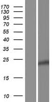 DPPL1 / PPAPDC1B Protein (Over-Expression Lysate Myc-DDK (Flag))