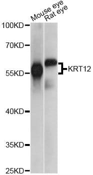 KRT12 / CK12 / Cytokeratin 12 Antibody