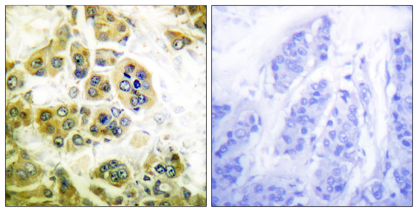 IKK Alpha+Beta Antibody (Internal)