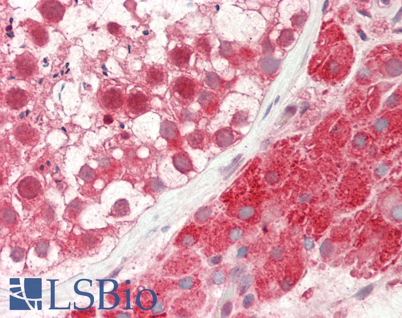 Polyclonal Rabbit anti-Human CSNK2A2 Antibody (aa251-300, IHC, WB)