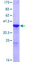 Human GMFG Protein (Recombinant GST)