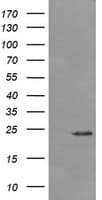 DPCD Antibody (clone OTI4B9)