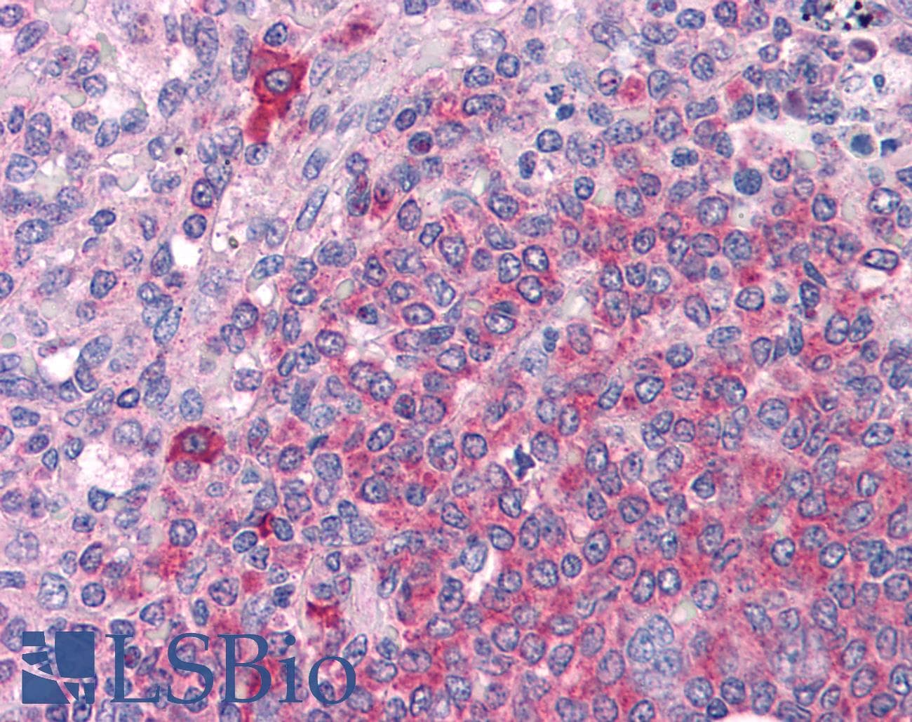 IHC-plus™ BTK Antibody