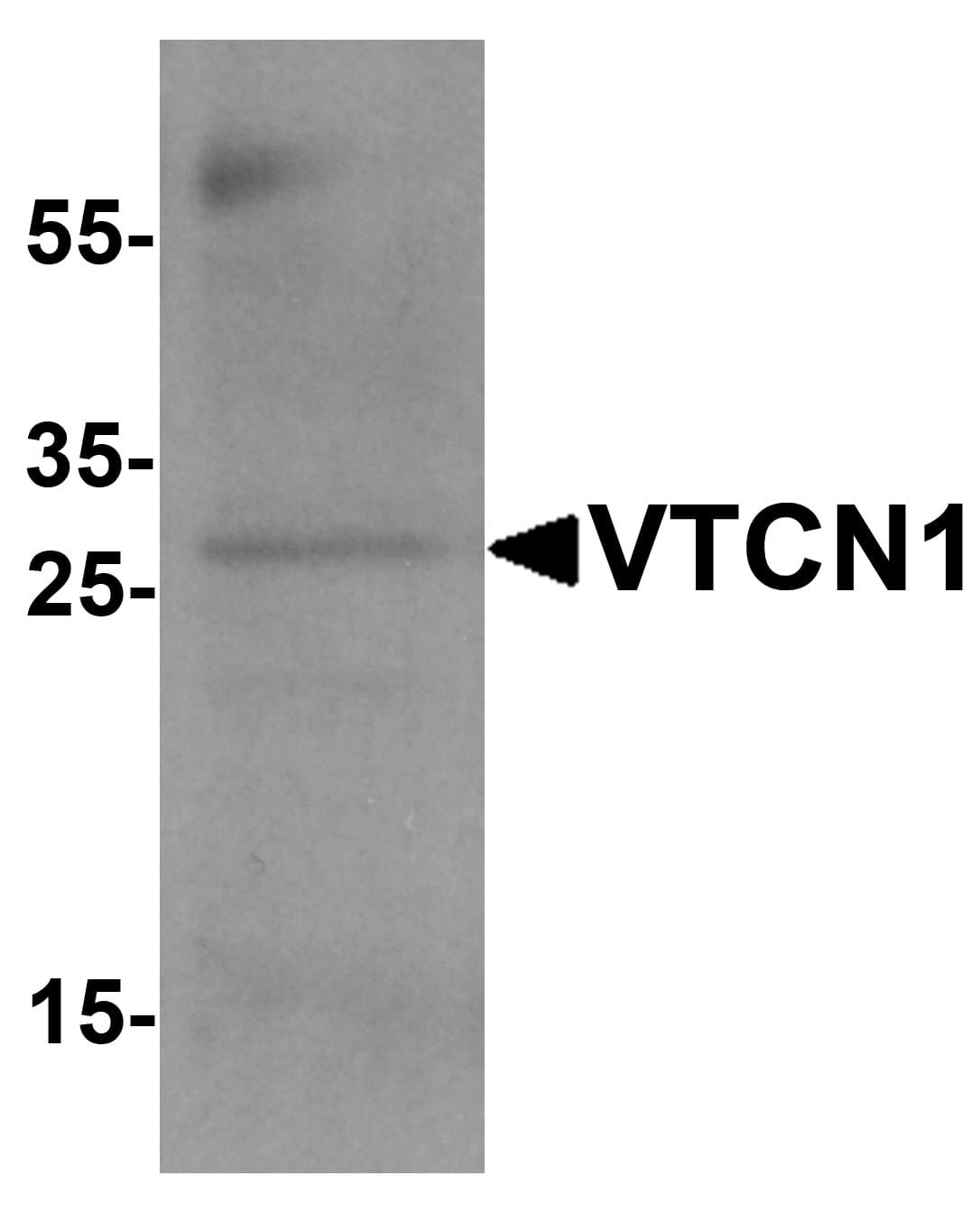 Polyclonal Rabbit anti-Human VTCN1 / B7-H4 Antibody (WB)