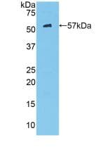 HK2 / Hexokinase 2 Antibody (aa605-868)