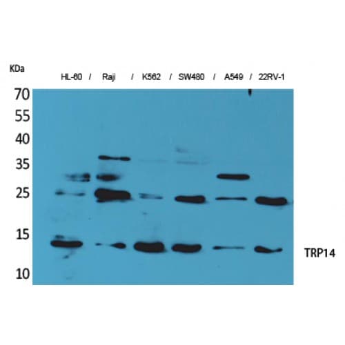 TXNDC17 Antibody (20-100 aa, Internal)