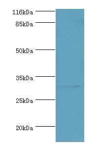 KLK5 / Kallikrein 5 Antibody (aa23-293)