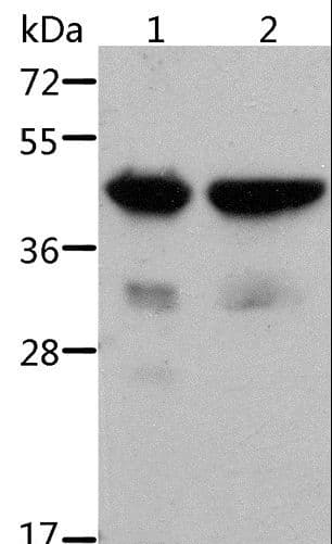 Polyclonal Rabbit anti-Human ACTA1 / Skeletal Muscle Actin Antibody (IHC, WB)