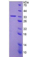 Human TP53 / p53 Protein (Recombinant His, N-Terminal)