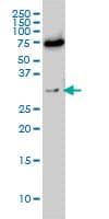 EXOSC8 Antibody (clone 1G5)