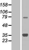 SMN1 Protein (Over-Expression Lysate Myc-DDK (Flag))