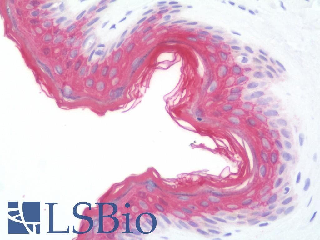 IHC-plus™ KRT13 / CK13 / Cytokeratin 13 Antibody (clone 3G4)