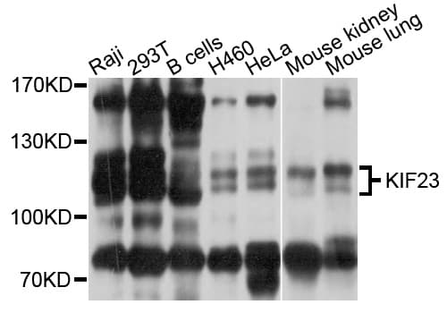 KIF23 / MKLP1 Antibody