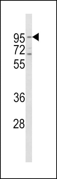 CD71 / Transferrin Receptor Antibody (aa649-677)