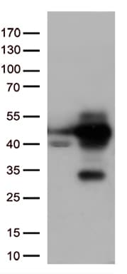 MAPK14 / p38 Antibody (aa2-360, clone OTI5A6)