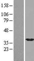 NPL / C112 Protein (Over-Expression Lysate Myc-DDK (Flag))