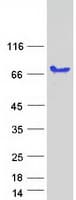 Human PALM2 Protein (Recombinant Myc-DDK (Flag))