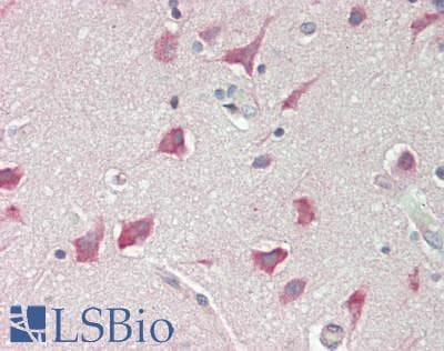 IHC-plus™ Polyclonal Rabbit anti-Human TPT1 / TCTP Antibody (aa70-120, IHC, IF, WB)