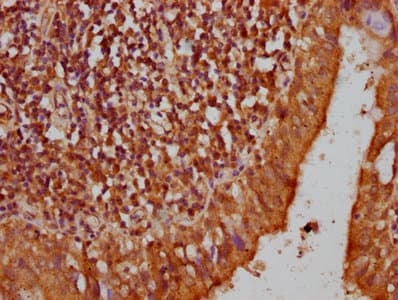 Pyrin / MEFV / MEF Antibody