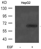 Polyclonal Rabbit anti-Human ATF2 Antibody (IHC, IF, WB)
